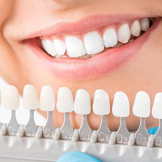 What To Expect During Your Cosmetic or Dental Implant Appointment